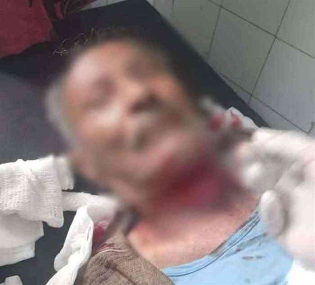 شاهد.. نجاة الناشري من محاولة ذبح وسط مدينة تعز