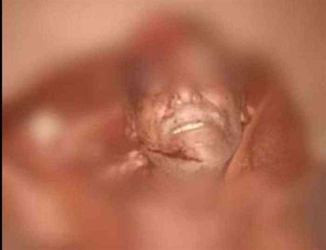 عدن.. ضبط المتهم بقتل العقيد الضنبري في المنصورة