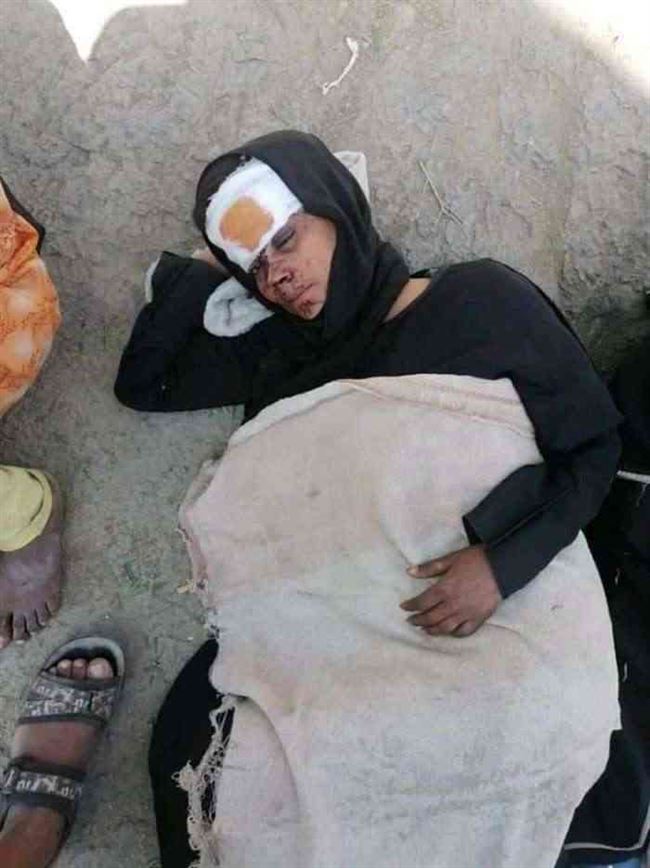 شاهد.. اعتداء وحشي على أسرة مواطن تبنى قضية إغتصاب طفلة بتعز