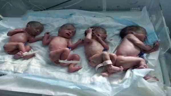 3 توأم قبل 7 سنوات.. واليوم تنجب 4 إناث في صنعاء وتتمتع بصحة جيدة.. الأم الثلاثينية