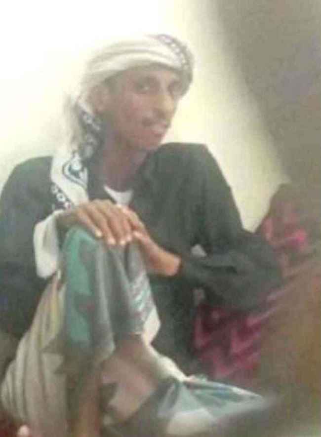 رؤيته صدمت الجميع.. عاد إلى أسرته بعد 12 عام من الإخفاء في سجون الحوثي بصعدة