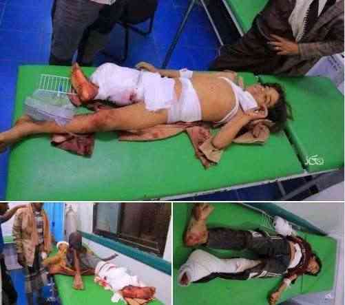 بعد ساعات على مقتل والده .. وفاة طفل من ضحايا الاستهداف الحوثي