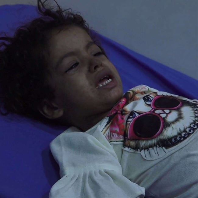 تقرير أميركي يتهم الحوثي خلف انتشار الأمراض في اليمن