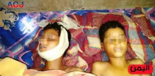 مركز أمريكي يكشف جريمة قتل بشعة ارتكبها مسلحو الحوثي بحق طفلين في الدهنة