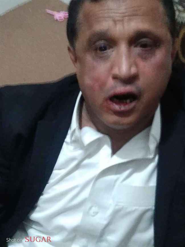 قيادات حوثية تهدد رئيس إذاعة في صنعاء بعد أسابيع من ضربه بوحشية