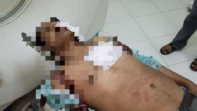 شاهد.. قصف حوثي يخلف ضحايا مدنيين بتعز