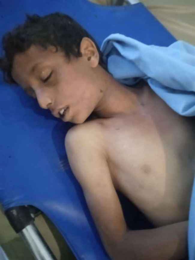 أغتصاب وقتل.. جريمة بشعه تهز محافظة تعز