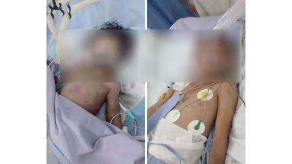 الضنك يفتك بأهالي تعز .. وفاة طفلين شقيقين والأهالي يستغيثون