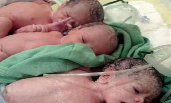 بعمر الـ20.. أم تنجب 3 توأم إناث في صنعاء