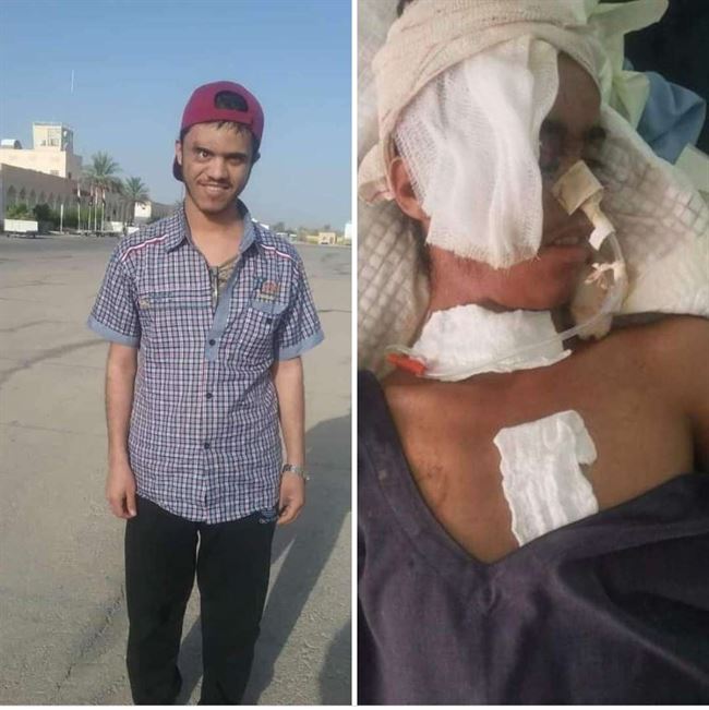 الحوثيون يصفون الحبجي بعد التناوب على تعذيبه في 3 محافظات