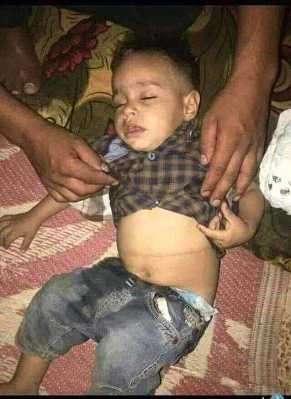 الكشف عن جرائم رعب في صنعاء يرتكبها الحوثيون داخل مجازر سرية بهذه المستشفيات