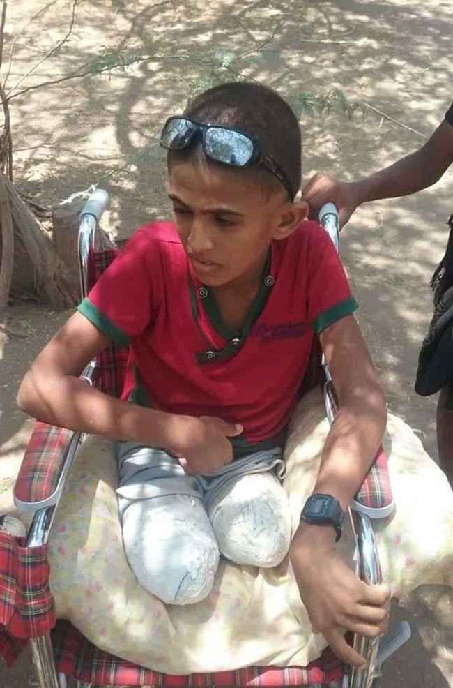 زراعة حوثية لمطاردة وقتل اطفال اليمنيين