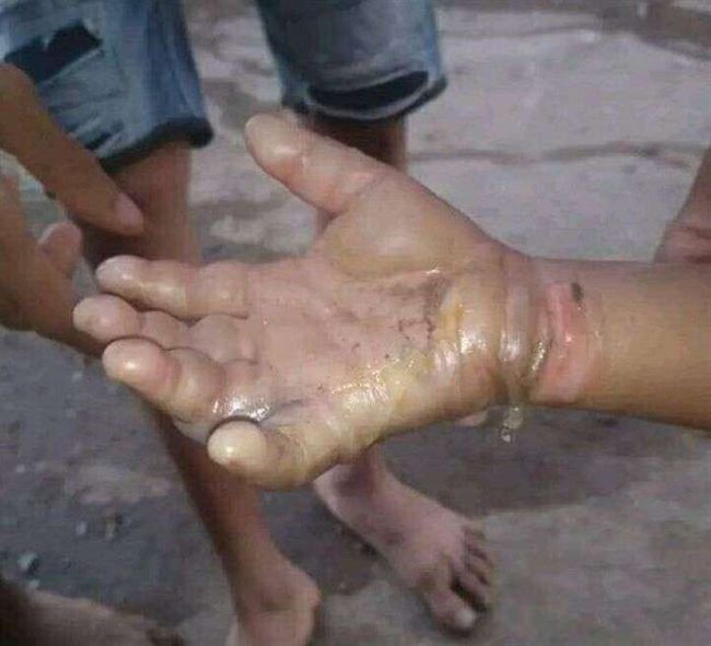 الصبيحي يهز عدن بجريمة بشعة ضحيتها طفله في ربيعه الـ3