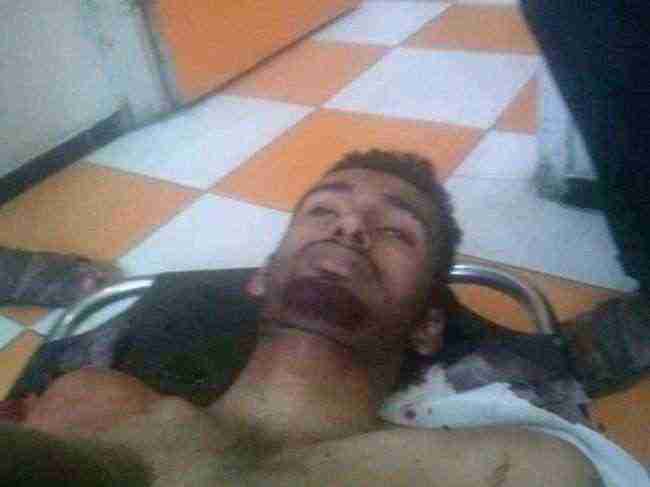 مسلحون مجهولون يغتالون مواطناً في تعز