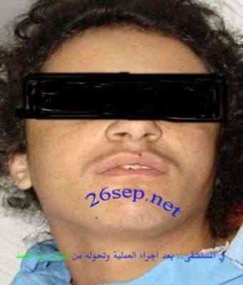 شاهد: فتاة تتحول إلى رجل في صنعاء قبل أسبوع من زواجها