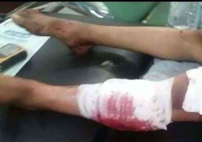 سقوط ضحايا مدنين بقصف حوثي استهدف حفل زفاف في الضالع